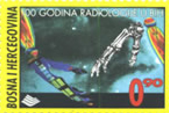 JUBILEJI – 100 godina radiologije u BiH